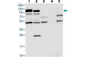 Western blot analysis of Lane 1: RT-4, Lane 2: U-251 MG, Lane 3: Human Plasma, Lane 4: Liver, Lane 5: Tonsil with OAS3 polyclonal antibody  at 1:250-1:500 dilution. (OAS3 antibody)