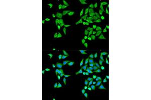 Immunofluorescence analysis of MCF-7 cell using CES2 antibody. (CES2 antibody  (AA 310-410))