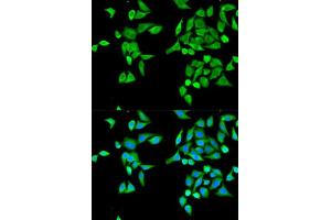 Immunofluorescence analysis of MCF-7 cell using CES2 antibody. (CES2 antibody  (AA 310-410))