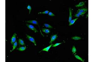 Immunofluorescent analysis of Hela cells using ABIN7161494 at dilution of 1:100 and Alexa Fluor 488-congugated AffiniPure Goat Anti-Rabbit IgG(H+L) (NCF1 antibody  (AA 63-232))