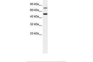 Image no. 1 for anti-Choroideremia-Like (Rab Escort Protein 2) (CHML) (AA 122-171) antibody (ABIN6735875) (CHML antibody  (AA 122-171))