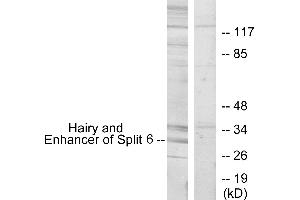 Western blot analysis of extracts from HeLa cells, using HES6 antibody.