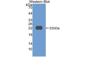 Western Blotting (WB) image for anti-Cylindromatosis (Turban Tumor Syndrome) (CYLD) (AA 170-338) antibody (ABIN3205178) (CYLD antibody  (AA 170-338))