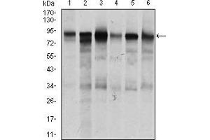 Western blot analysis using TGFBR3 mouse mAb against Jurkat (1), HeLa (2), MCF-7 (3), F9 (4), SK-N-SH (5), and NIH3T3 (6) cell lysate. (TGFBR3 antibody  (AA 147-328))