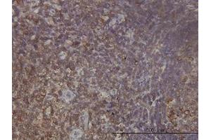 Image no. 1 for anti-Ribosomal Protein L9 (RPL9) (AA 93-192) antibody (ABIN598584) (RPL9 antibody  (AA 93-192))