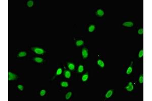 Immunofluorescent analysis of Hela cells using ABIN7143861 at dilution of 1:100 and Alexa Fluor 488-congugated AffiniPure Goat Anti-Rabbit IgG(H+L) (Ensa antibody  (AA 1-121))