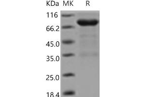 Western Blotting (WB) image for Netrin receptor UNC5B (UNC5B) protein (Fc Tag) (ABIN7321225) (UNC5B Protein (Fc Tag))