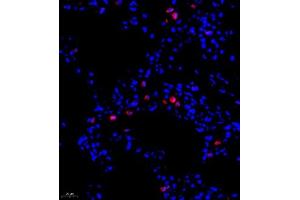 Immunofluorescence of paraffin embedded rat lung using ADI1 (ABIN7072888) at dilution of 1:1200 (400x lens) (ADI1 antibody)