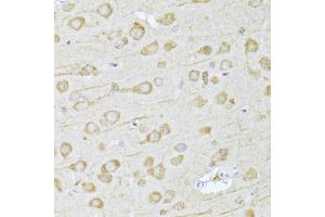 Immunohistochemistry of paraffin-embedded rat brain using FDPS Antibody (ABIN2562571) at dilution of 1:100 (40x lens).