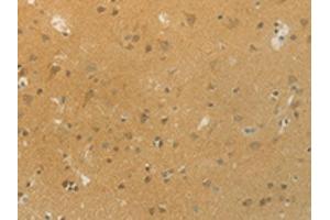 The image on the left is immunohistochemistry of paraffin-embedded Human brain tissue using ABIN7192532(SLC9A3 Antibody) at dilution 1/20, on the right is treated with synthetic peptide. (SLC9A3 antibody)