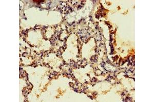Immunohistochemistry of paraffin-embedded human lung tissue using ABIN7165919 at dilution of 1:100 (PPP1R16B antibody  (AA 101-400))
