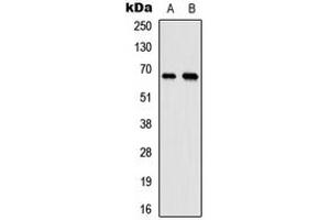 Western blot analysis of MEN expression in HeLa (A), mouse testis (B) whole cell lysates. (MEN (Center) antibody)