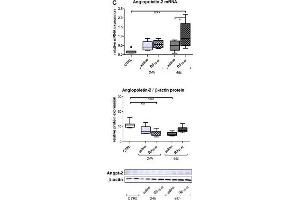 Bβ15-42 favors angiogenesis. (Angiopoietin 2 antibody)
