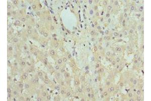 Immunohistochemistry of paraffin-embedded human liver tissue using ABIN7153202 at dilution of 1:100 (FBP1 antibody  (AA 1-338))