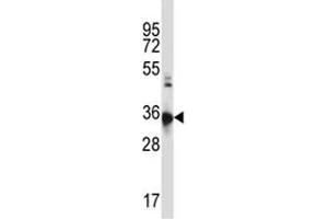 CCR10 antibody western blot analysis in HL-60 lysate (CCR10 antibody  (AA 1-30))