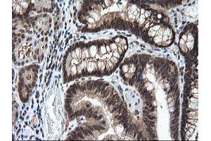 Image no. 5 for anti-Leucine Zipper and CTNNBIP1 Domain Containing (LZIC) antibody (ABIN1499239) (LZIC antibody)