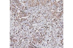 IHC analysis of HLA-DRA using anti-HLA-DRA antibody (ABIN7600948). (HLA-DRA antibody  (AA 26-254))