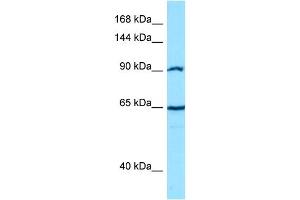 Host: Rabbit Target Name: CTNNA2 Sample Type: PANC1 Whole cell lysates Antibody Dilution: 1. (CTNNA2 antibody  (C-Term))