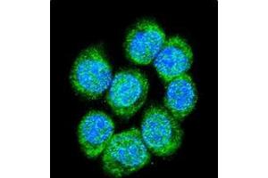 Confocal immunofluorescent analysis of Catenin beta-1 Antibody (C-term) Cat. (CTNNB1 antibody  (C-Term))