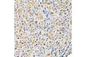 Immunohistochemistry of paraffin-embedded rat ovary using RBBP9 Rabbit pAb (ABIN6129095, ABIN6146752, ABIN6146753 and ABIN6220638) at dilution of 1:200 (40x lens). (RBBP9 antibody  (AA 1-186))
