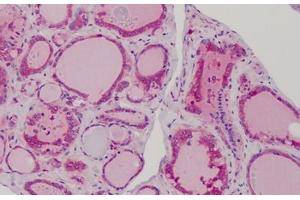 Human Thyroid: Formalin-Fixed, Paraffin-Embedded (FFPE) (MAD2L1 antibody  (AA 1-174))