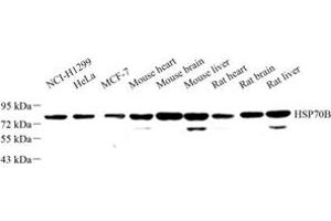 Western blot analysis of HSP70B (ABIN7074173) at dilution of 1: 500 (HSPA6 antibody)