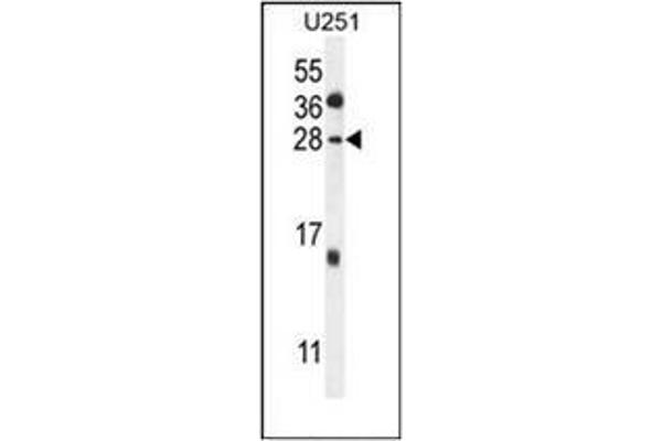 GGTLC2 antibody  (Middle Region)