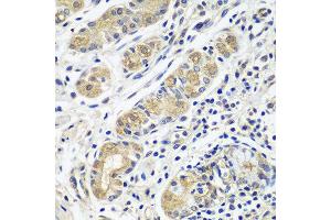 Immunohistochemistry of paraffin-embedded human stomach using GPRC5A antibody at dilution of 1:100 (40x lens). (GPRC5A antibody)