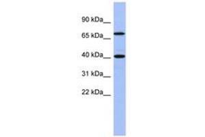 Image no. 1 for anti-SLAIN Motif Family, Member 2 (SLAIN2) (AA 71-120) antibody (ABIN6743288)