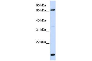 WB Suggested Anti-ACSL4 Antibody Titration: 0. (ACSL4 antibody  (N-Term))