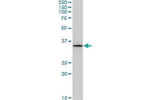 BDH1 monoclonal antibody (M03A), clone 4B3. (BDH1 antibody  (AA 1-343))