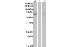 HEK293 lysate (10ug protein in RIPA buffer) over expressing Human MKRN1 with DYKDDDDK tag probed with ABIN5539936 (1ug/ml) in Lane A and probed with anti- DYKDDDDK Tag (1/1000) in lane C.