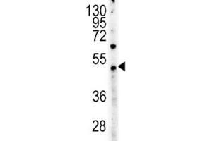 c-Myc antibody western blot analysis in HeLa lysate (Myc Tag antibody  (AA 408-439))