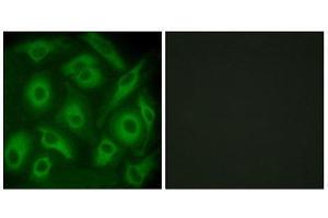 Immunofluorescence (IF) image for anti-Cadherin 23 (CDH23) (N-Term) antibody (ABIN1850224) (CDH23 antibody  (N-Term))