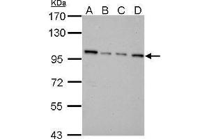 WB Image NNT antibody detects NNT protein by Western blot analysis.