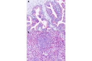Immunohistochemical staining of formalin-fixed paraffin-embedded human prostate (A) and human spleen (B) with GPR63 polyclonal antibody . (GPR63 antibody  (Extracellular Domain))