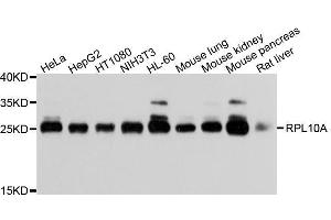 Western blot analysis of extracts of various cell lines, using RPL10A antibody. (RPL10A antibody  (AA 1-110))
