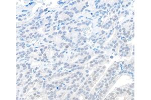 Immunohistochemistry (IHC) image for anti-Chromosome 11 Open Reading Frame 30 (C11orf30) (C-Term) antibody (ABIN7454601) (EMSY antibody  (C-Term))
