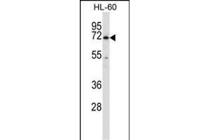 BTK Antibody (N-term) (ABIN657469 and ABIN2846497) western blot analysis in HL-60 cell line lysates (35 μg/lane). (BTK antibody  (N-Term))