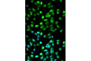 Immunofluorescence analysis of HeLa cell using TCF4 antibody. (TCF4 antibody  (AA 400-500))