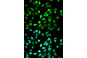 Immunofluorescence analysis of HeLa cell using TCF4 antibody.
