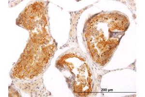 Immunostaining (ISt) image for anti-Sarcolemma Associated Protein (SLMAP) (AA 677-784) antibody (ABIN521687)