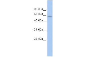 WB Suggested Anti-LEMD2 Antibody Titration: 0. (LEMD2 antibody  (Middle Region))