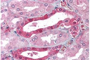 Human Kidney (formalin-fixed, paraffin-embedded stained with CA2 antibody ABIN214022 at 5 ug/ml followed by biotinylated goat anti-rabbit IgG secondary antibody ABIN481713, alkaline phosphatase-streptavidin and chromogen. (CA2 antibody)