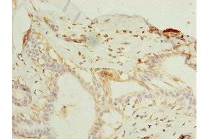 Immunohistochemistry (IHC) image for anti-ELAV (Embryonic Lethal, Abnormal Vision, Drosophila)-Like 4 (Hu Antigen D) (ELAVL4) (AA 1-150) antibody (ABIN7151487)