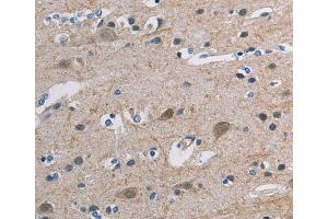 Immunohistochemistry (IHC) image for anti-Tonsoku-Like, DNA Repair Protein (NFKBIL2) antibody (ABIN2427657) (NFKBIL2 antibody)