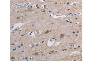 Immunohistochemistry (IHC) image for anti-Tonsoku-Like, DNA Repair Protein (NFKBIL2) antibody (ABIN2427656) (NFKBIL2 antibody)