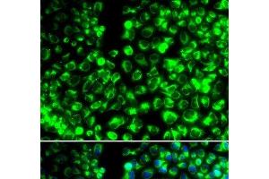 Immunofluorescence analysis of HeLa cells using CALU Polyclonal Antibody (CALU antibody)