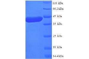 SDS-PAGE (SDS) image for Methyltransferase Like 11A (METTL11A) (AA 1-223), (full length) protein (His-SUMO Tag) (ABIN4975690) (METTL11A Protein (AA 1-223, full length) (His-SUMO Tag))