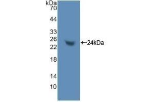 Detection of Recombinant TNPO1, Human using Polyclonal Antibody to Transportin 1 (TNPO1) (Transportin 1 antibody  (AA 626-836))